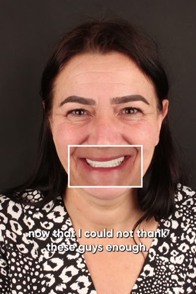 Smile Makeover in Turkey Clinichub