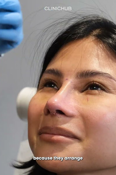 Clinichub Rhinoplasty Before After